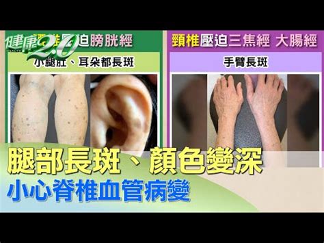 8+9特徵 耳朵黑斑